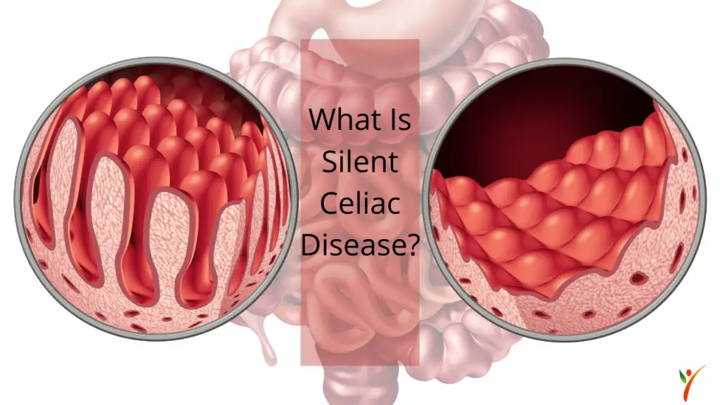 Silent Celiac Disease Symptoms